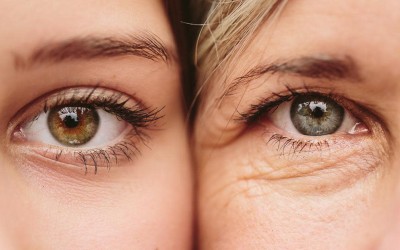 علاج جفاف العين