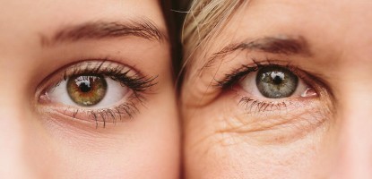 علاج جفاف العين